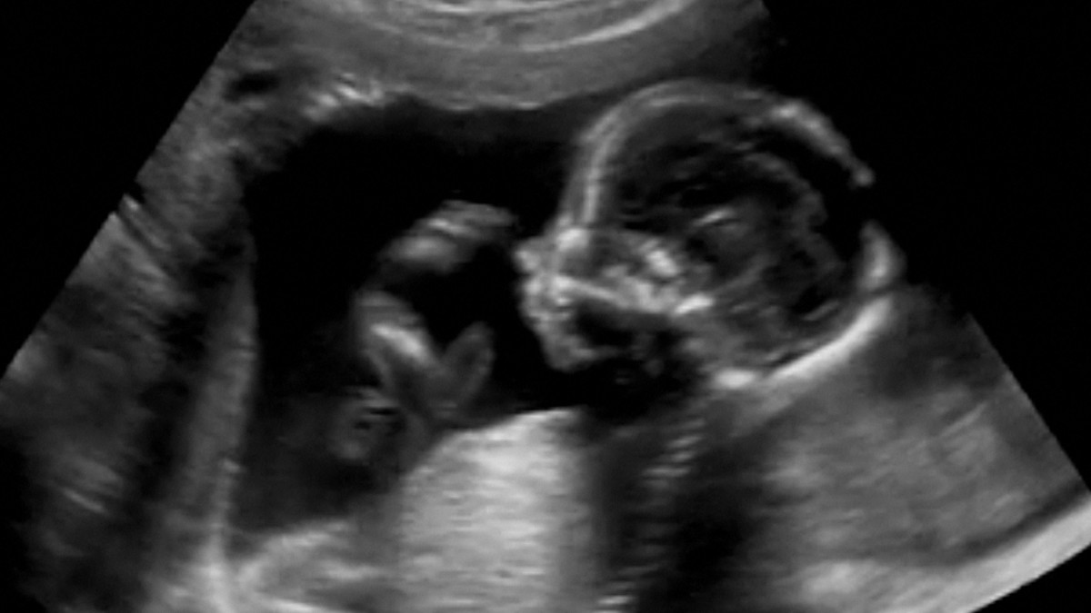 Luca Yupanqui avrà un album i debutto chiamato "Sounds Of The Unborn".Credits Shutterstock: GagliardiPhotography